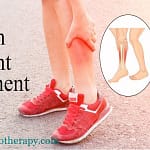 shin splint Treatment