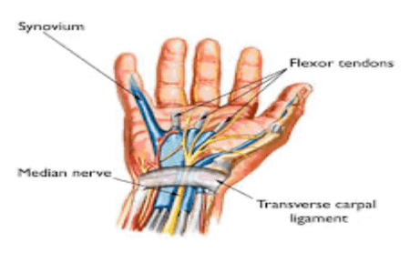 Carpal Tunnel Syndrome Causes, Diagnosis and Treatment | Pain Free