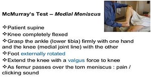 Meniscus Tear6