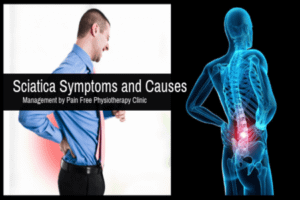 Sciatica Symptoms Causes | Pain Free Physiotherapy Clinic.