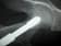 Orthopedic Implants